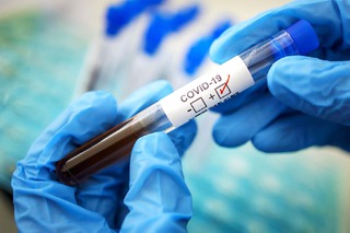 На Ставрополье коронавирусом заболели 65 человек, 44 выздоровели