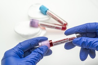 На Ставрополье за время пандемии проведено 265 тысяч тестов на коронавирус