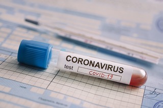 На Ставрополье за сутки коронавирус подтвердился у 1022 человек