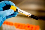 Новости: Тестирование на коронавирус
