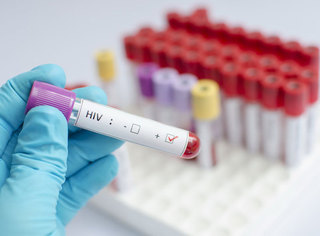 Медики проверили более 2 тысяч жителей Ставрополья на ВИЧ