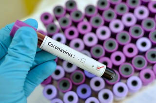 На Ставрополье за сутки коронавирус подтвердился у 132 человек, выздоровели 153