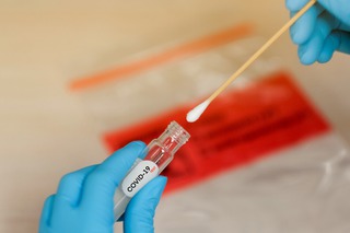 На Ставрополье за сутки выявили 62 случая заболевания коронавирусом