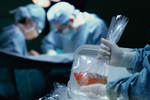 Новости: Трансплантация органов
