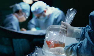 На Ставрополье смогут проводить операции по трансплантации органов