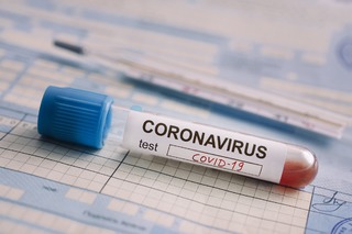 За сутки коронавирус подтвердился у 245 жителей Ставрополья
