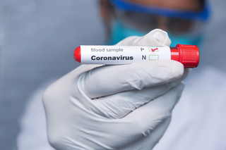 На Ставрополье изменились правила проведения тестов на коронавирус