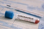 Новости: Тест на коронавирус