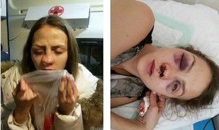 Избитая жителем Ессентуков москвичка оказалась сотрудницей телеканала «Россия 1»